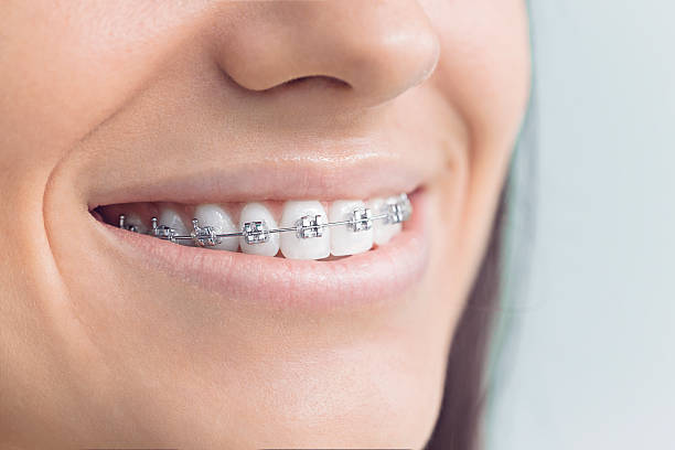 Best Wisdom Tooth Removal  in Coral Terrace, FL